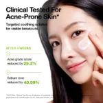 Anua - Azelaic Acid Cica Skin Soothing Moisturizer - Image 5